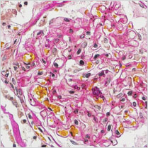 CoolLED’s new pE-100-WHT replaces 100W Halogen