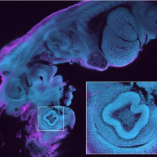 What we Owe to the Invention of the Microscope