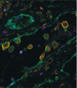 Choice of Illumination System & Fluorophore for Multiplex Immunofluorescence on FFPE