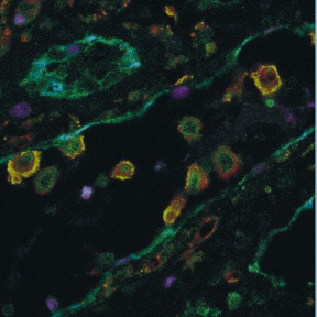 Choice of Illumination System & Fluorophore for Multiplex Immunofluorescence on FFPE Tissue Sections 