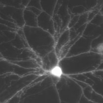 CoolLED pE-4000 working with cultured hippocampal neurons.