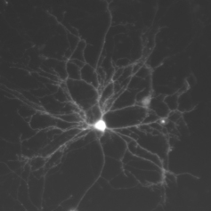 Cultured hippocampal neurons. (CoolLED pE-4000)
