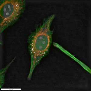 Triple-stained fixed HeLa cells overlaid with holotomography. (Nanolive/CoolLED pE-300<sup>ultra</sup>)