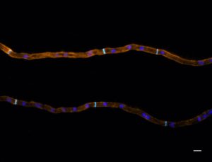 Neurospora crassa hyphal filaments.