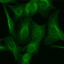 The Importance of Optical Filters when using LED Illumination for Fluorescence Microscopy