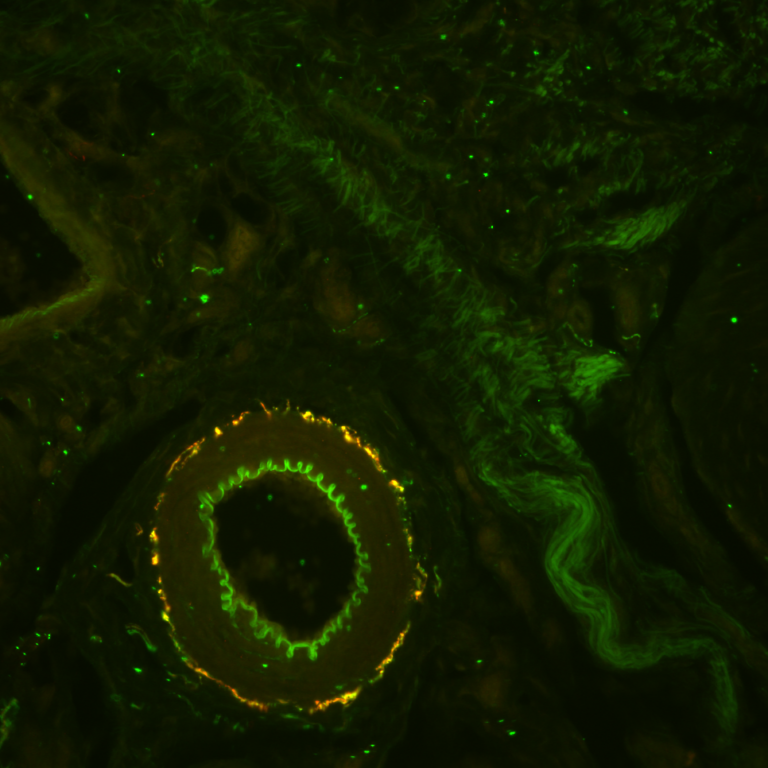 Higher irradiance, lower cost