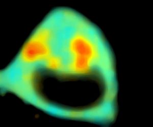 Win a pE-300ultra LED Illumination System