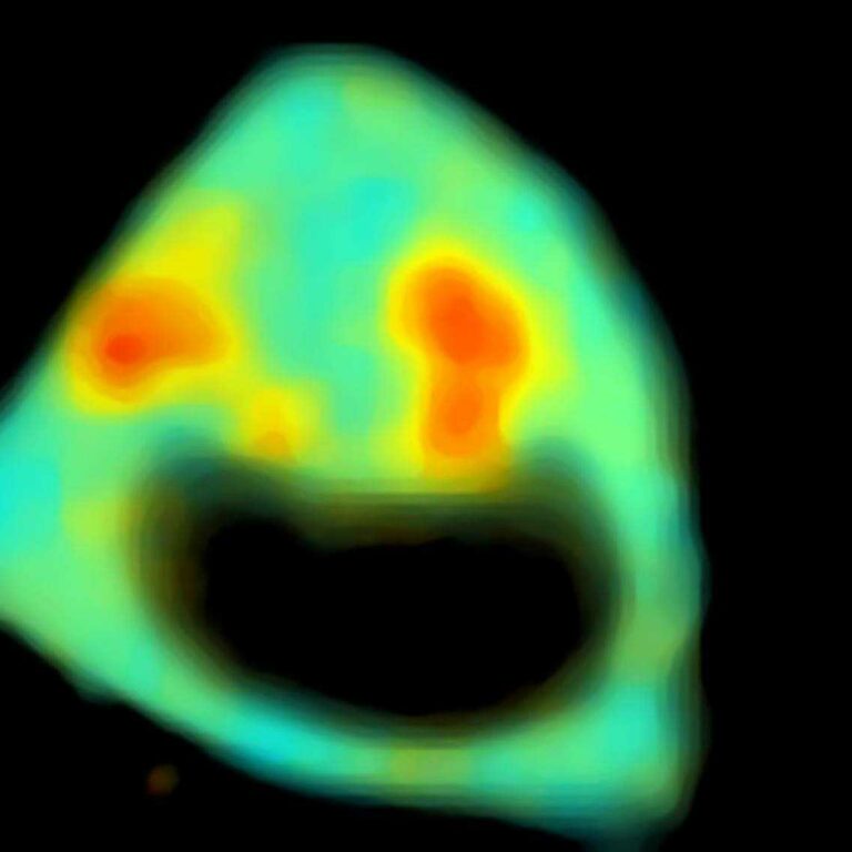 You’ve still got time to win a pE-300<sup>ultra</sup>