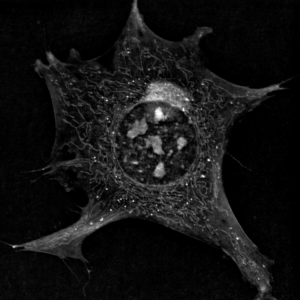 Label-free live cell image of a pre-adipocyte cell.