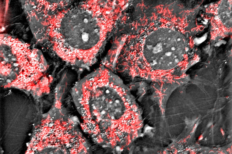 Under the Microscope #7: Where fluorescence and label-free imaging meet