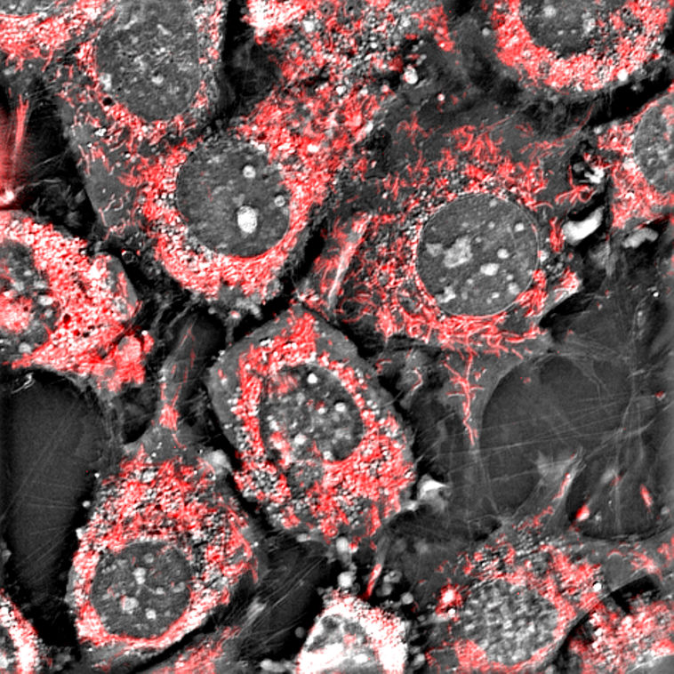 Under the Microscope #7: Where fluorescence and label-free imaging meet