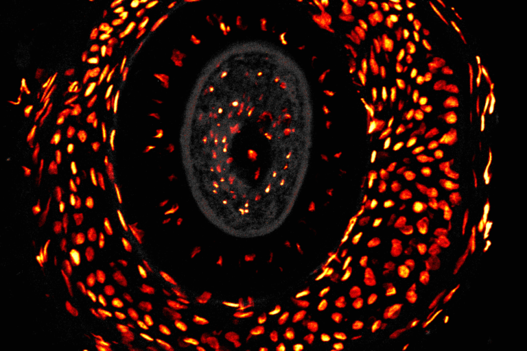 And the winner is…