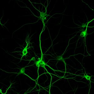 Primary neuron from a rat cortex – supplied by Transnetyx Tissue by BrainBits (CoolLED pE-800)