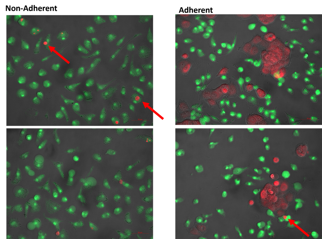 Fluorescence microscopy images optimising phagocytosis