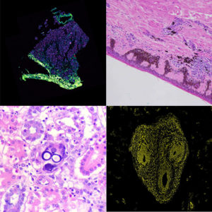 Vote for Your Favourite Image in an Image