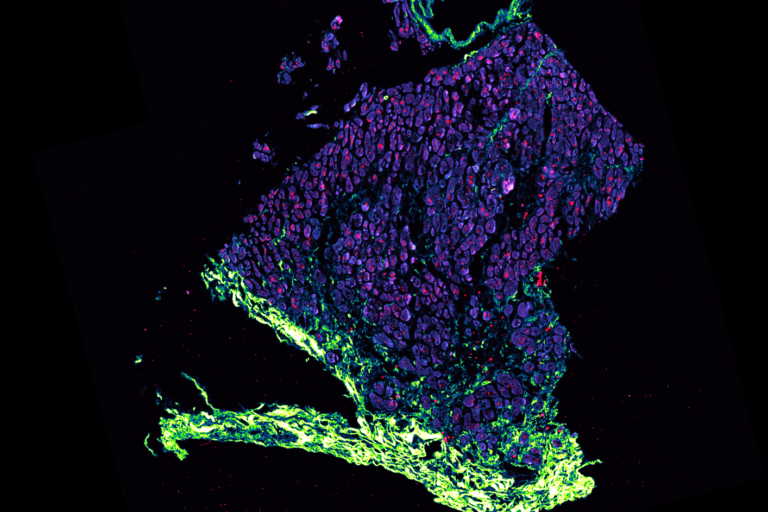 Announcing the lucky winner of a pE-300<sup>ultra</sup> Microscope Illumination System!