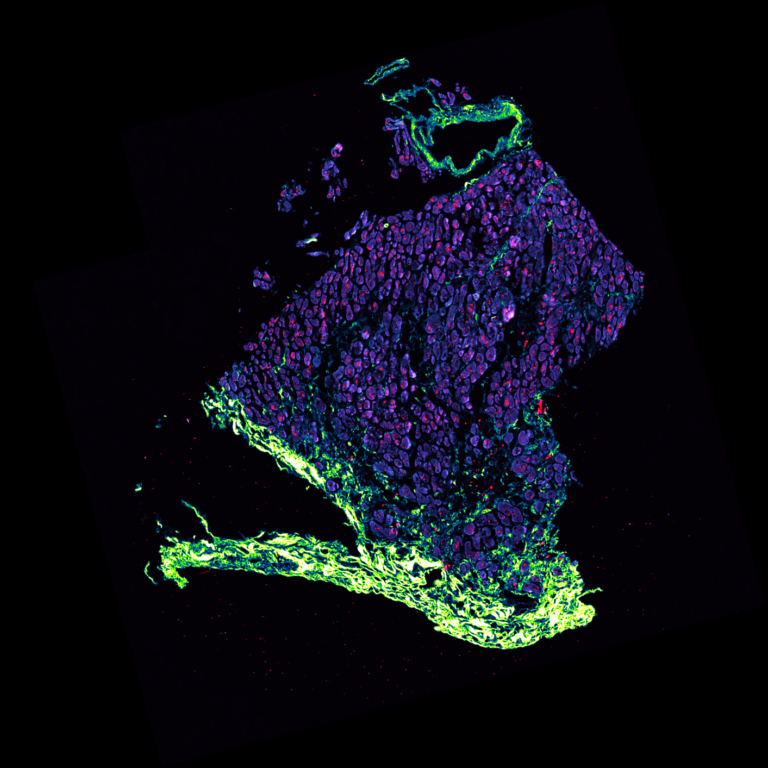 Announcing the lucky winner of a pE-300<sup>ultra</sup> Microscope Illumination System!