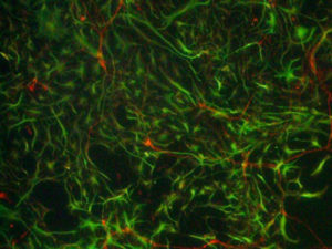 Neurofilament / GFAP / bisBenzimide Neuronal Coverslips from E18 Sprague Dawley Rat Cortex – supplied by Transnetyx Tissue by BrainBits (CoolLED pE-300<sup>white</sup>)