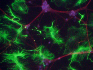 E18 Rat Dissociated Astrocytes Cortex – supplied by Transnetyx Tissue by BrainBits (CoolLED pE-300<sup>white</sup>)