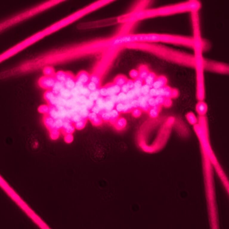 New Application Note: Detecting cyanobacteria with the pE-300lite Microscope Illuminator