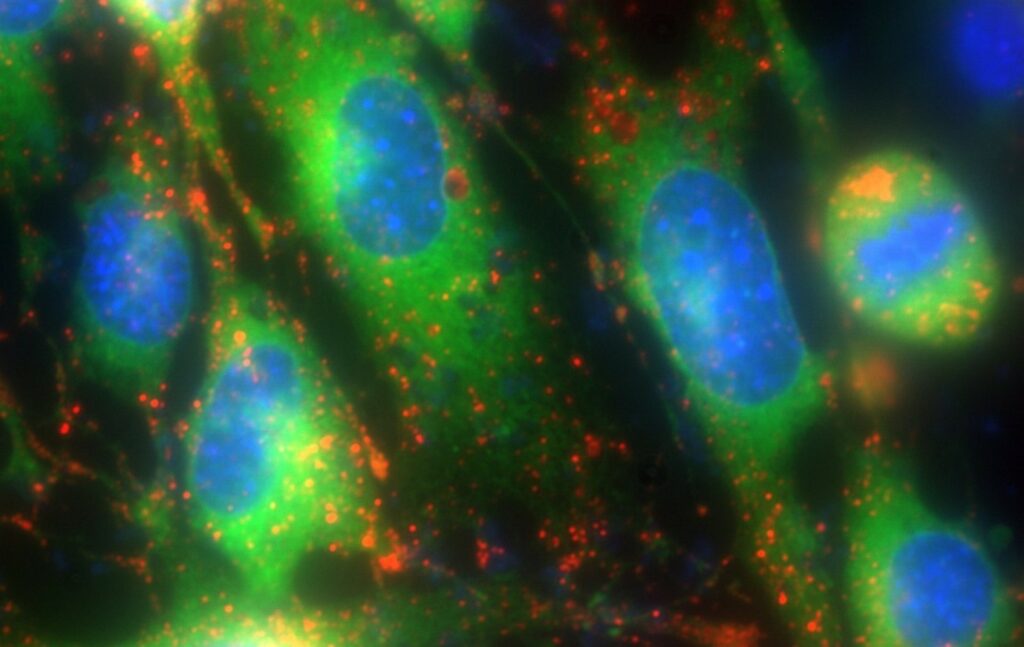 Martin Bootman Triple labelled HEK cells showing the endoplasmic reticulum (ER Tracker, green), lysosomes (LysoBrite, red), and cell nuclei (Hoescht, blue)