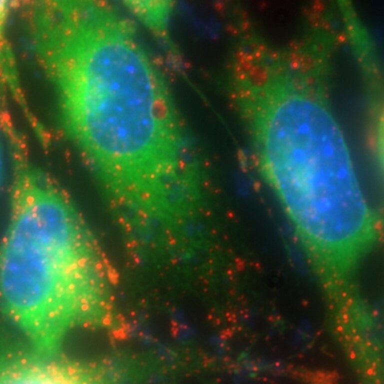 Which Calcium Imaging Light Source Should You Choose?