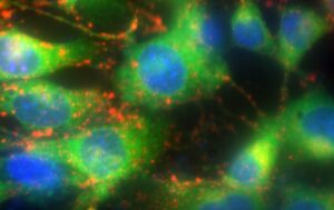 Celebration, Change and The Future