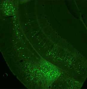 Mouse brain section stained with anti-GFP (pE-400<sup>max</sup>)