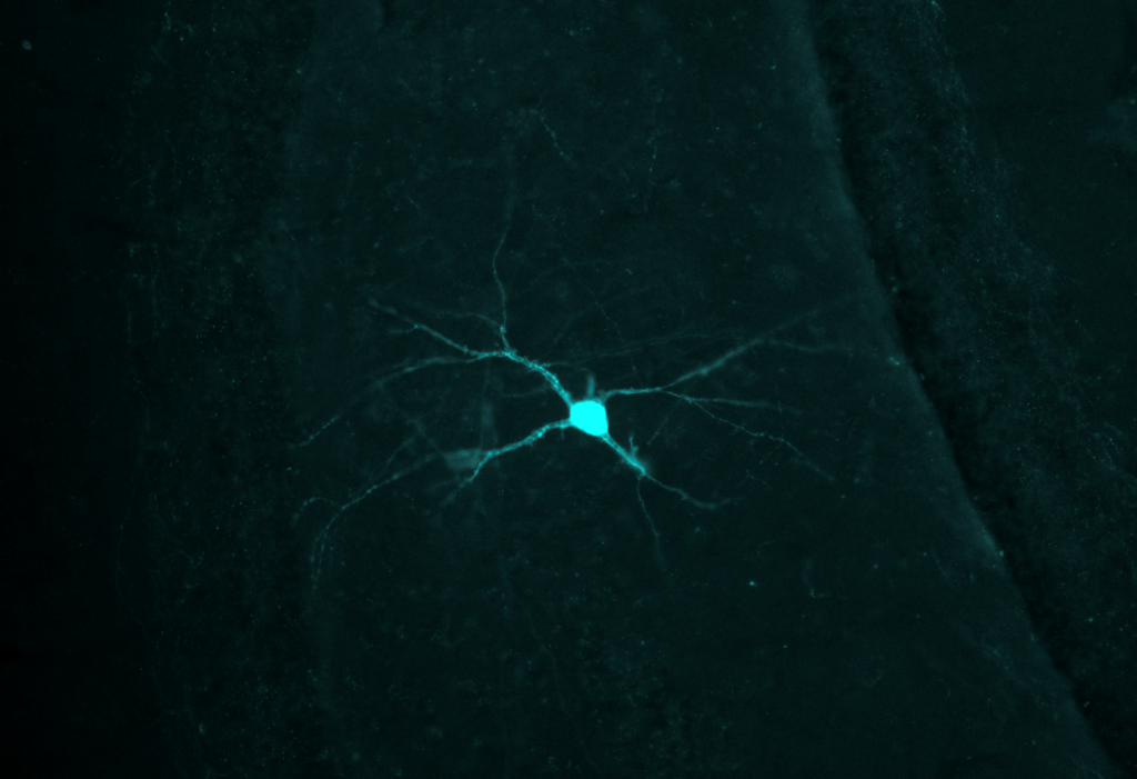 Mouse brain section stained with anti GFP; taken using a CoolLED pE 400max; Images courtesy of Dr. Kate Peters, Uni. of Sussex 2 Mouse brain section stained with anti GFP; taken using a CoolLED pE 400max; Images courtesy of Dr. Kate Peters, Uni. of Sussex 2