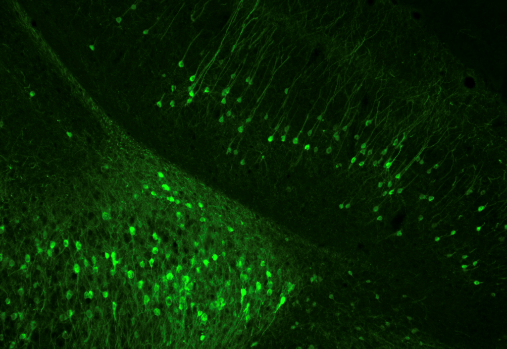 Mouse brain section stained with anti GFP; taken using a CoolLED pE 400max; Images courtesy of Dr. Kate Peters, Uni. of Sussex 3 Mouse brain section stained with anti GFP; taken using a CoolLED pE 400max; Images courtesy of Dr. Kate Peters, Uni. of Sussex 3