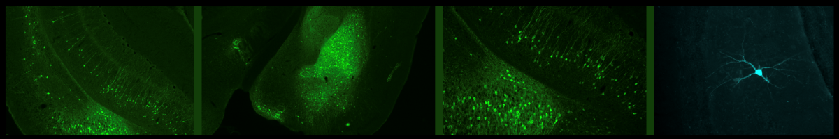 pE 400max Images (1)