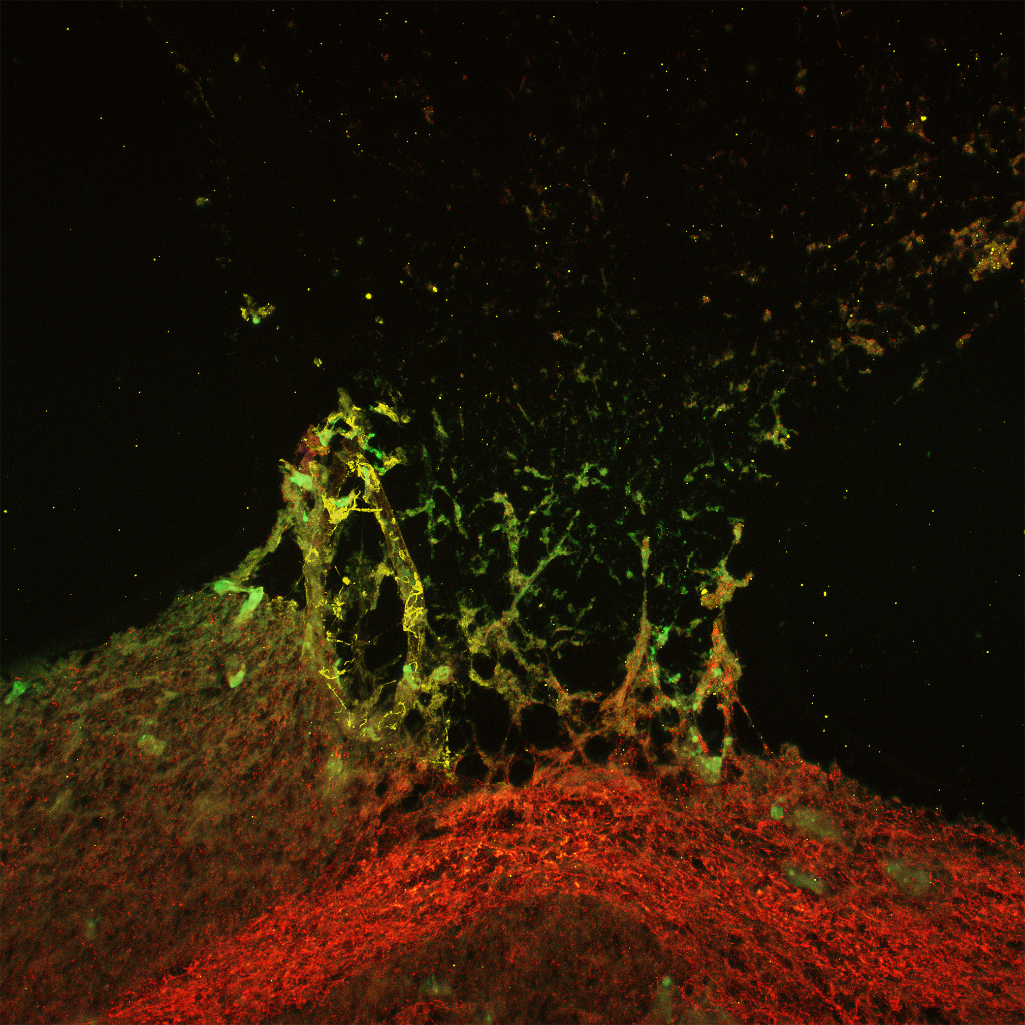 Kseniia Bondarenko Volcanic Eruption