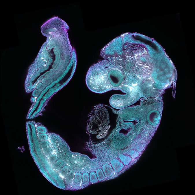 Lin Li Bao Butterflies in the Stomach