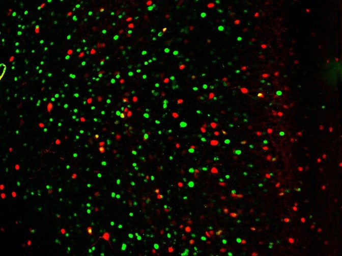 Immunohistochemistry showing activated neurons expressing Fos (green fluorescent protein) and inhibitory neurons (marked with red fluorescent protein). Fluorescence excitation achieved with the CoolLED pE-400max. Immunohistochemistry showing activated neurons expressing Fos (green fluorescent protein) and inhibitory neurons (marked with red fluorescent protein). Fluorescence excitation achieved with the CoolLED pE-400max.