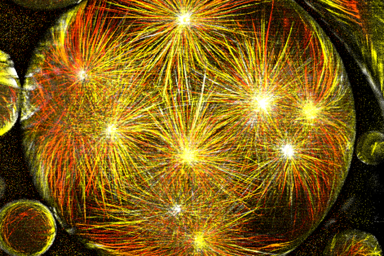 Image in an Image Competition – The Winner of a pE-400 Microscope Illuminator!