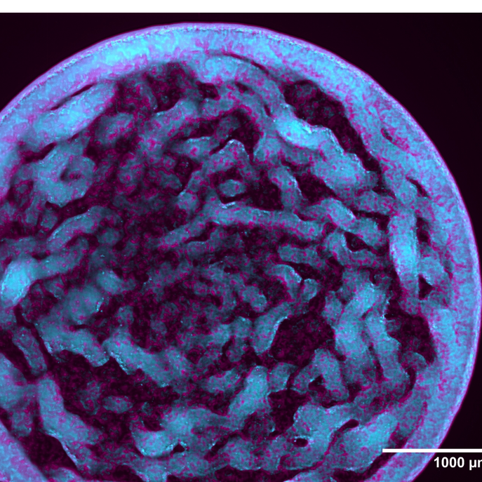 New App Note: How the pE-4000 is helping to show the bigger picture on Dual-Species Biofilms