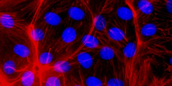 fluorescence fluorescence