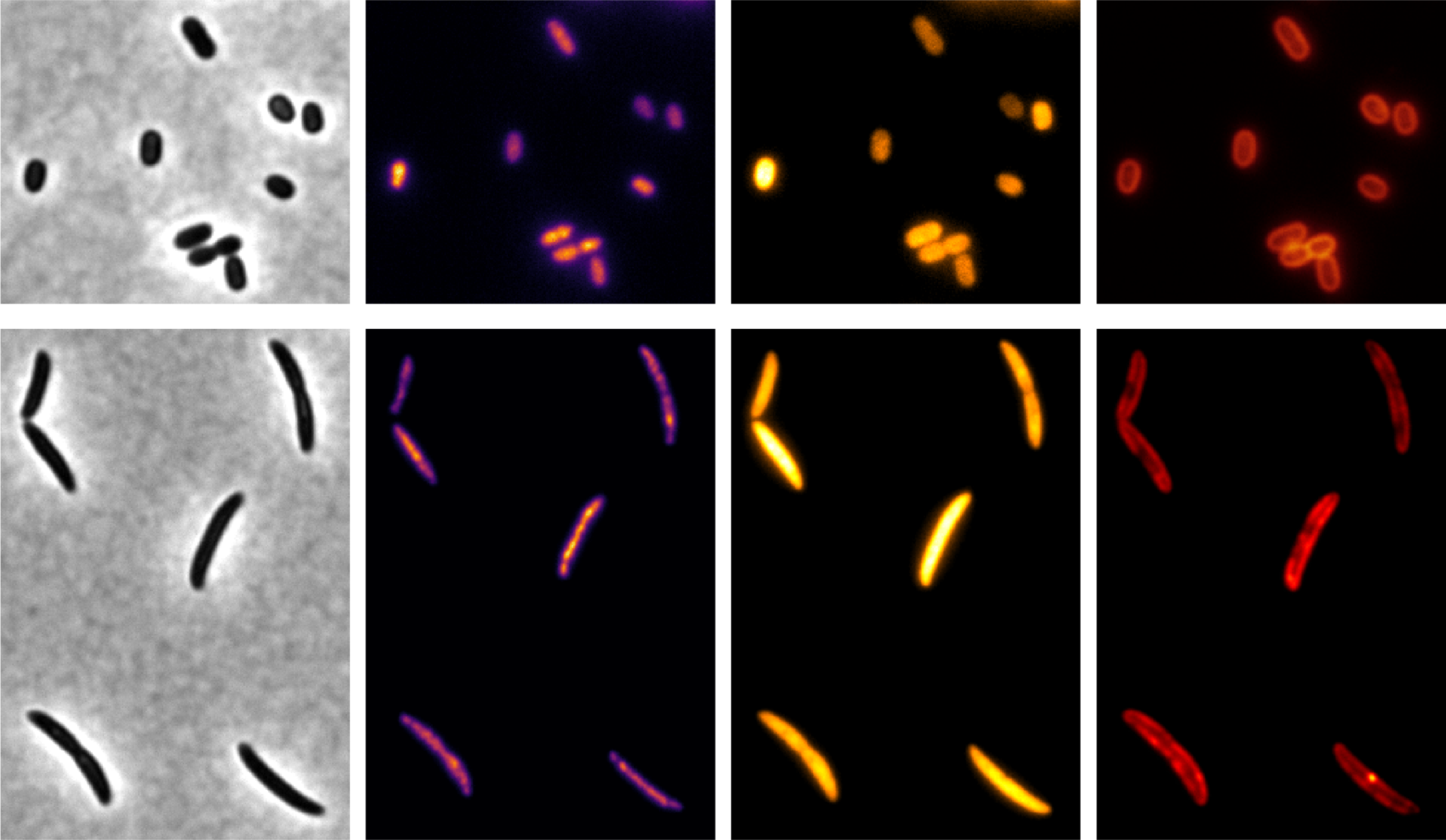 Brightfield and fluorescence microscopy images of gut bacteria